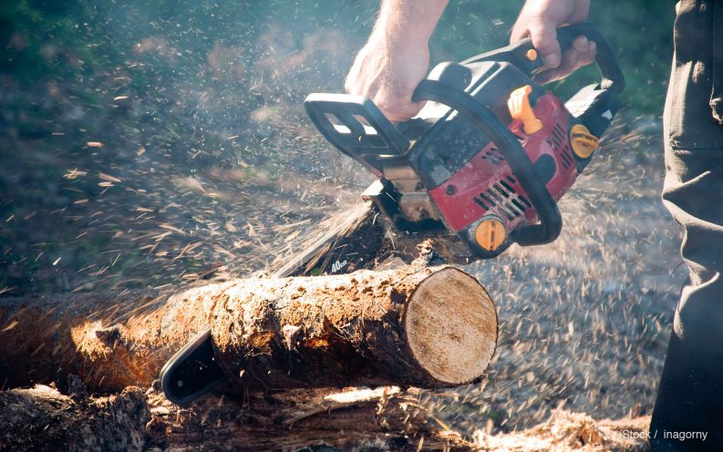 Chainsaw injury Chainsaw injury