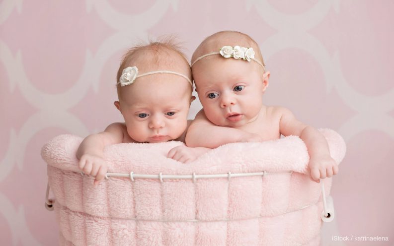 Odds of conjoined twins Odds of conjoined twins