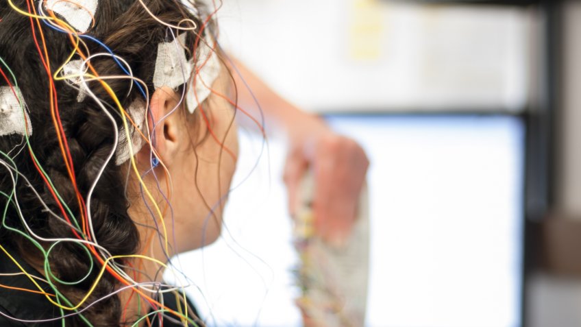 A stock photo of a close up of electrodes for an eeg test.