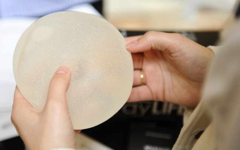 breast reconstruction breast reconstruction