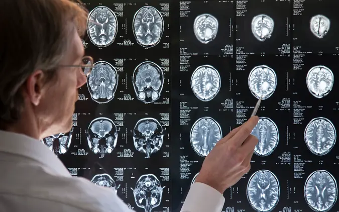 human brain mapping