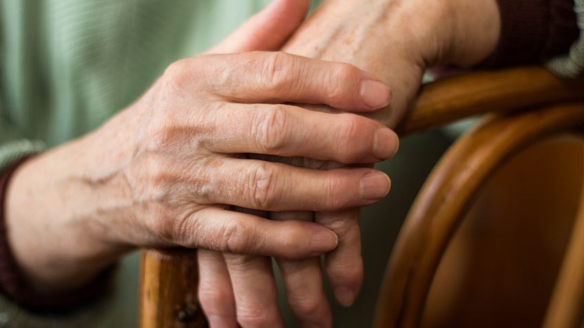 arthritis