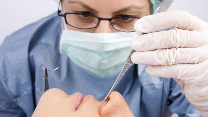rhinoplasty cosmetic surgery