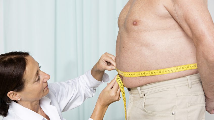 bariatric surgery