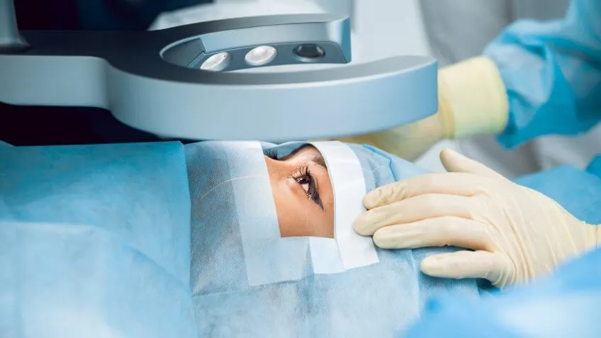 laser eye surgery