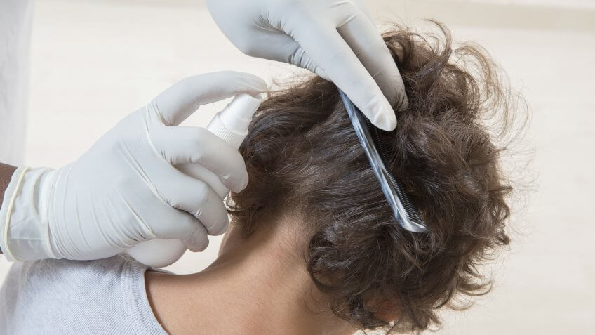 professional-lice-remover