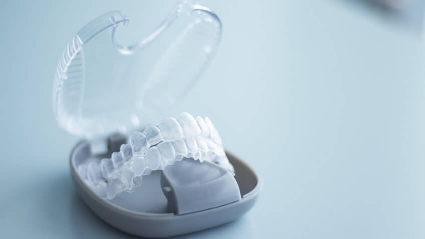 Invisalign
