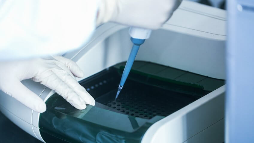 lab immune ELISA experiment.