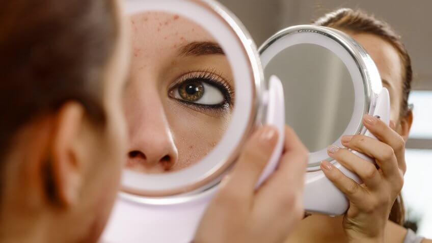 teenager with problematic skin looking in the mirror.