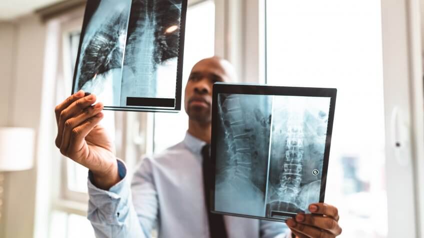 doctor reading the x-ray in the office.