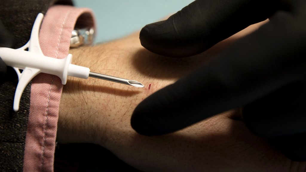 Swedish company implant employees with microchips, Gothenburt, Sweden - 02 Dec 2015A picture made available on 04 March 2017 of David Holecek (L) getting a chip implanted in his hand by Jowan Osterlund of the company Biohax, in Gothenburg, Sweden, 02 December 2015.