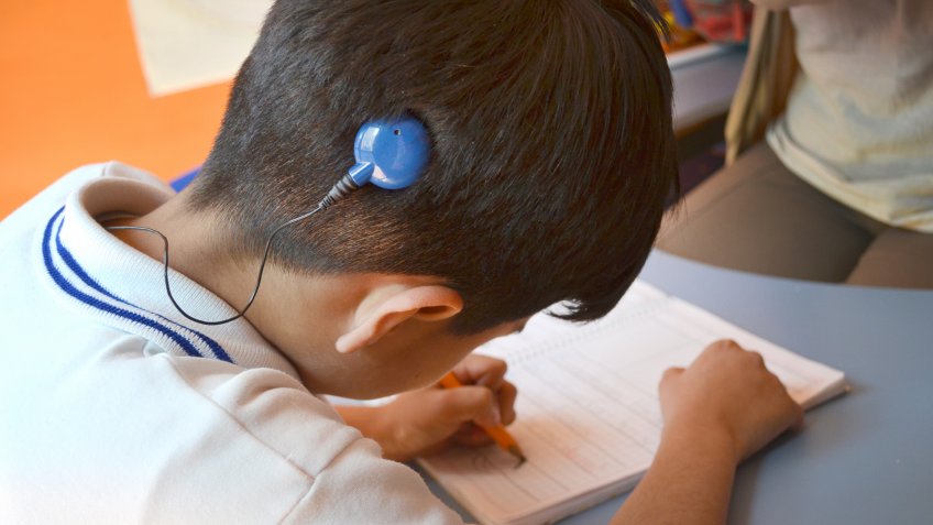 kid with cochlear implant
