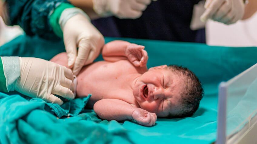doctor cutting baby's umbilical cord.