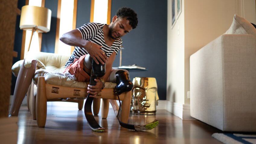 Young man putting prosthetic leg at home.