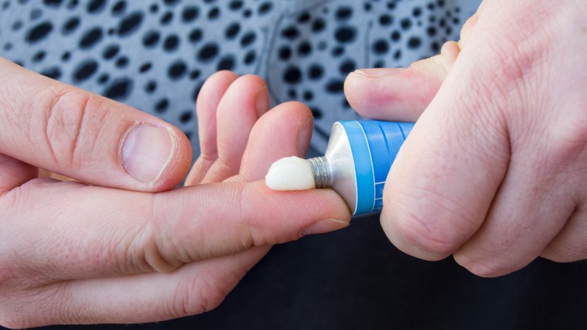 Patient squeezes out of aluminum tubes ointment with medicinal substance on finger.
